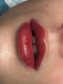 Татуаж губ сразу после процедуры